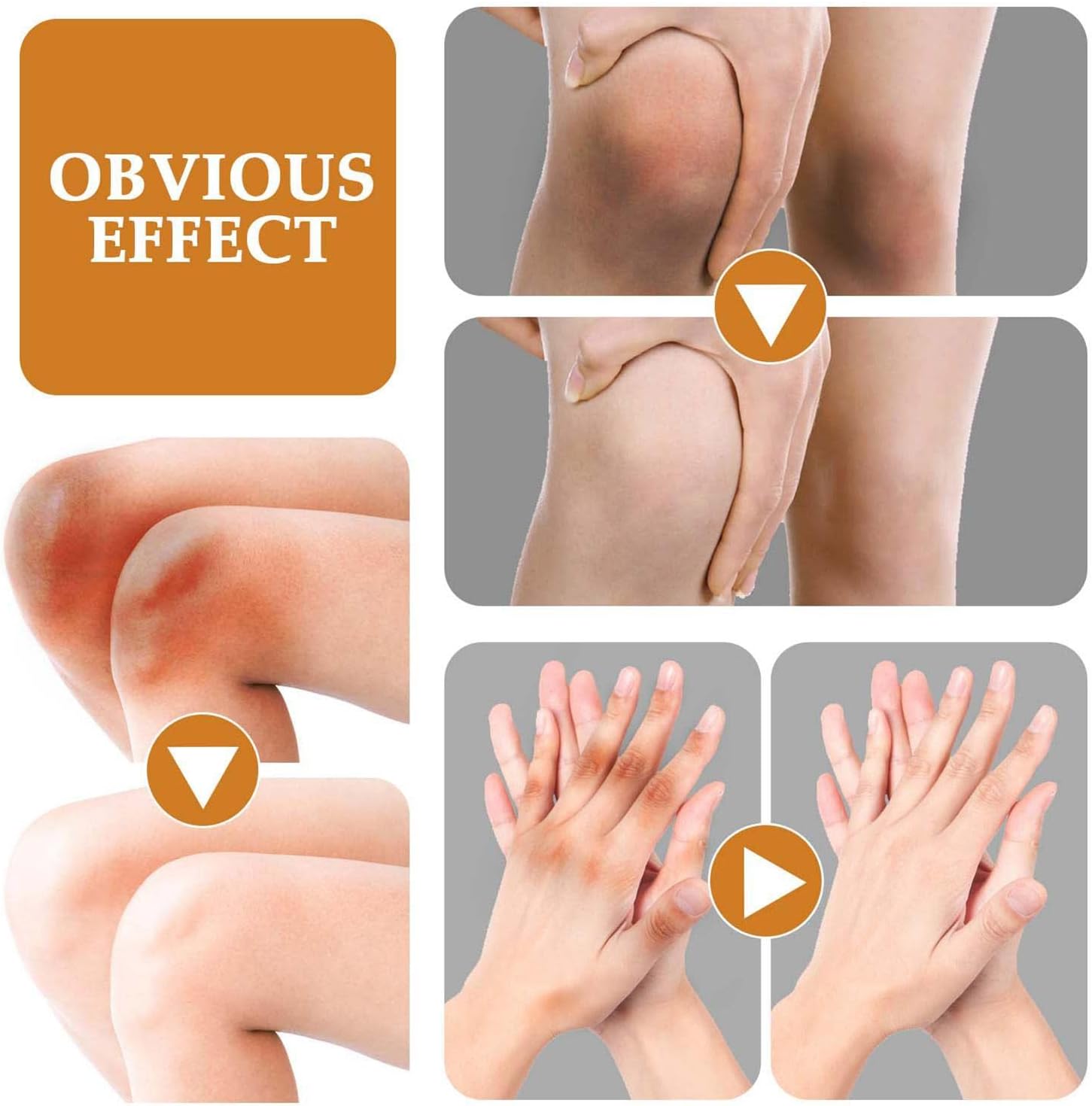 Jaysuing - Dark Spot Correcting Cream